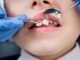 Copilul de 4 ani anesteziat la dentist este în moarte clinică