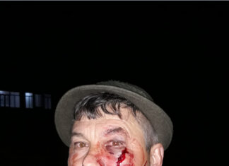 Paznic de vânătoare, la spital după o bătaie cruntă