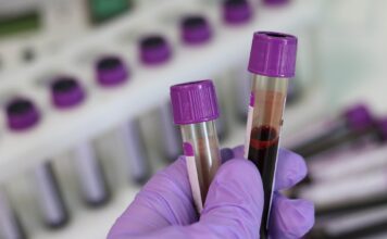 SCJU Constanța: medicul mort de coronavirus ieșise negativ la teste