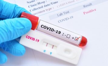 Rată de pozitivare Covid de 28,3%. Record la ATI