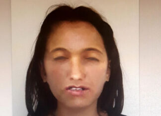 Polițiștii au o bănuială despre cine ar putea fi fata găsită arsă la Ghimpați