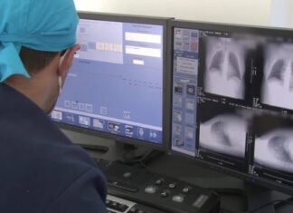 Spitalul Victor Babeș din Timișoara foloseşte o procedură unică pentru diagnosticarea cancerului de plămân Sursa foto: Spitalul „Dr. Victor Babeș” Timișoara