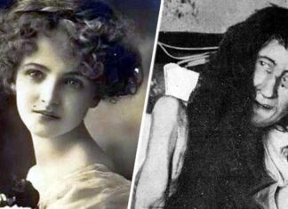 Povestea lui Blanche Monnier, femeia care a stat închisă într-o cameră, timp de 25 de ani Sursa foto: Wikipedia/Blanche Monnier