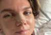 Simona Halep, de nerecunoscut după operația suferită la nas Simona operata