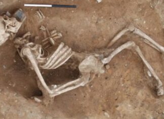 Cea mai veche intervenție chirurgicală ar fi avut loc acum 31.000 de ani Schelet