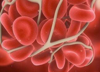 SUA a aprobat cel mai scump medicament din lume, pentru coagularea sângelui Hemofilie