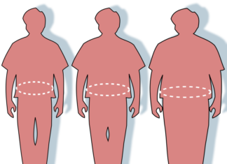 Plan guvernamental anti-obezitate în Italia Obezitate