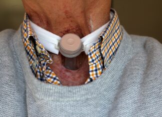 43% din decesele provocate de cancerul pulmonar sunt cauzate de poluare Cancer