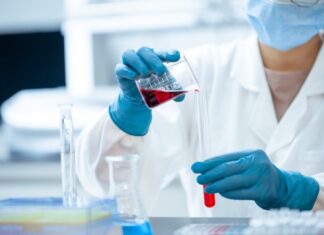 O asistentă de la Serviciul Medicină Legală Maramureș falsifica analizele de sânge ale șoferilor băuți Asistenta