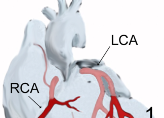 Avertismentul unui renumit medic cardiolog: Un sfert din numărul cazurilor de infarct apar la persoane sub 50 de ani Infarct