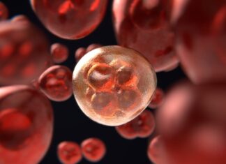 Numărul persoanelor nefumătoare care au cancer pulmonar, în creștere Celule cancer