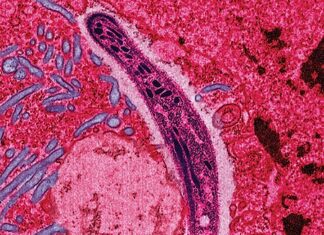 Patru români întorși recent din Zanzibar, diagnosticați cu malarie Malaria